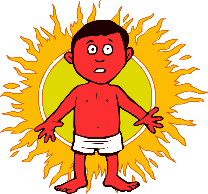 Sunburn - Man