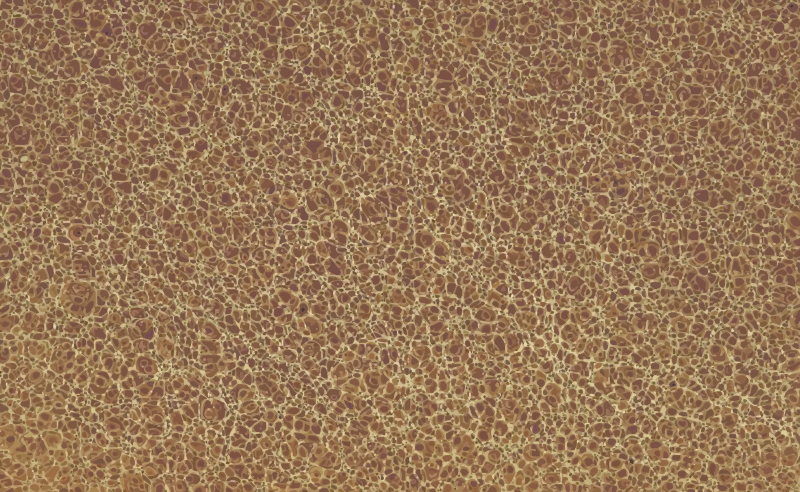 Foam pattern