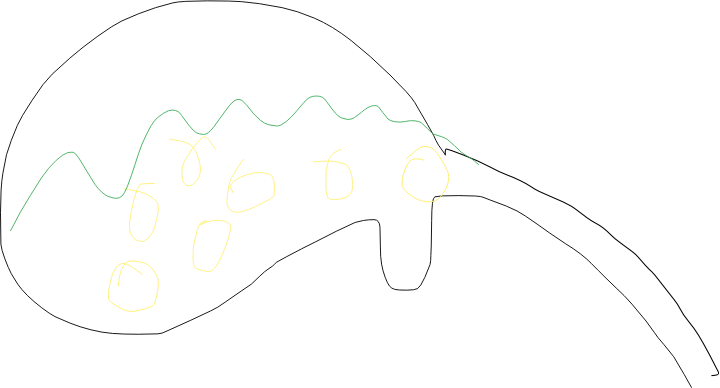 Vesicula